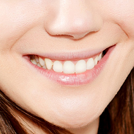 Veneers link